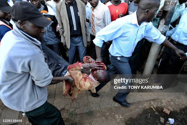 Man bleeding from the head and hands is carried away by plain-clothed police officers after he was involved in a skirmish over an undisclosed reason...