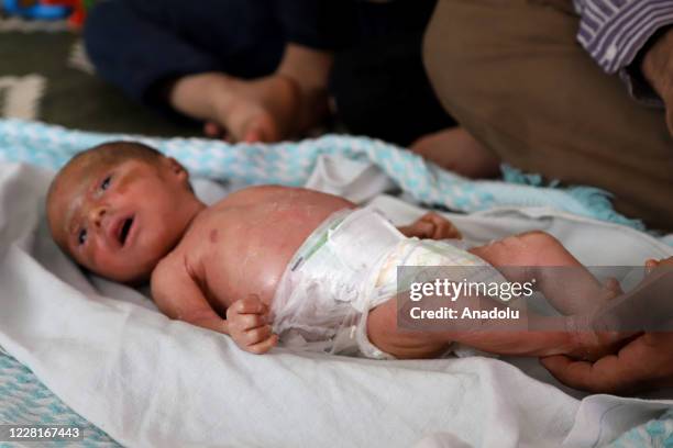 Syrian baby Mutaz who is just 18 days old with fish scale disease is seen in Sermin district of Idlib, Syria on August 22, 2020. Baby Mutaz and his...