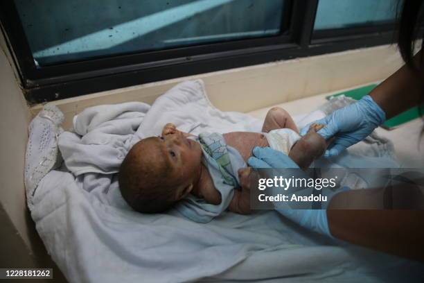 Day-old Syrian baby Mutaz with fish scale disease is seen in Hatay, Turkey on August 24, 2020. Baby Mutaz were brought to Turkey with his family, who...