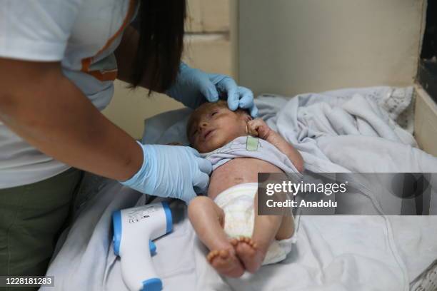 Day-old Syrian baby Mutaz with fish scale disease is seen in Hatay, Turkey on August 24, 2020. Baby Mutaz were brought to Turkey with his family, who...