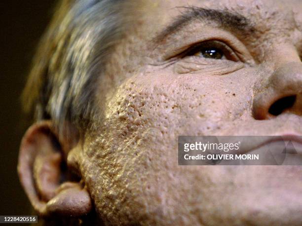 Photo taken 25 January 2005 at the Parliamentary assembly of the European Council in Strasbourg, of Ukraine's president Viktor Yushchenko's face....