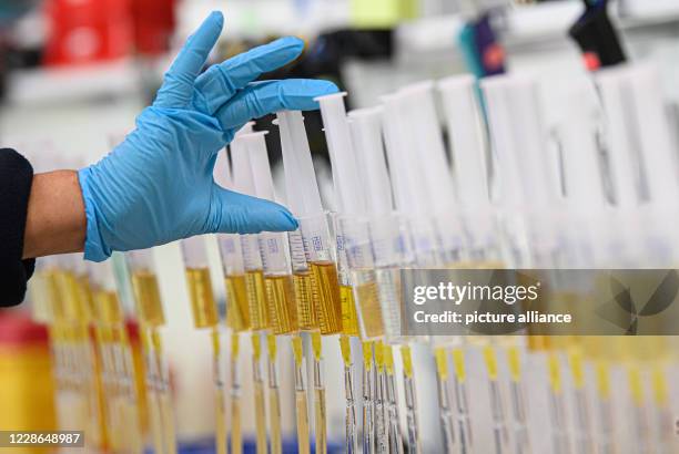 September 2020, Saxony, Kreischa: Syringes with urine are placed on a laboratory bench in the doping control laboratory at the Institute for Doping...