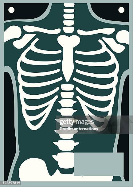 illustrazioni stock, clip art, cartoni animati e icone di tendenza di corpo umano x ray gabbia toracica - vertebrae