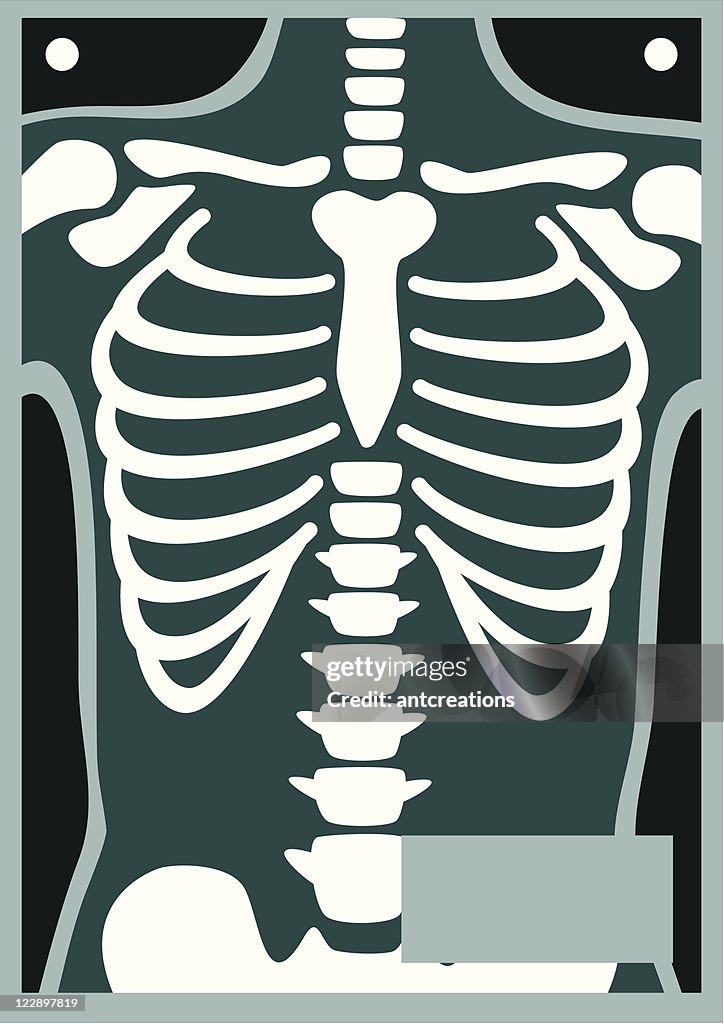 Human Body X Ray Rib Cage