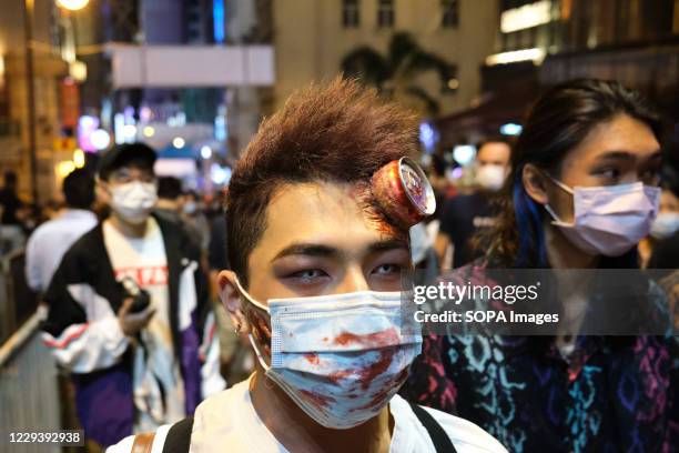 Participant in a costume during Halloween. Revellers take part in a Halloween street party in Lan Kwai Fong amid the Covid-19 pandemic.