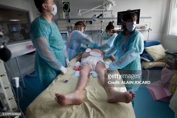 Medical staff tend to a patient in an intensive care unit for patients infected with the Covid-19 at the AP-HP Louis Mourier hospital in Colombes,...