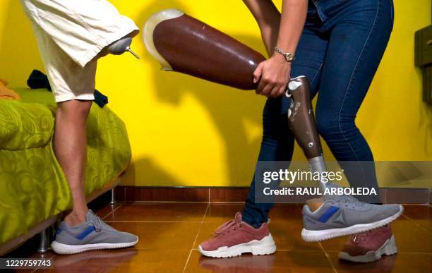 Colombian cyclist, former soldier Juan Jose Florian, aka "Mochoman," is assisted by his wife and trainer Angie Garces at their house in the...