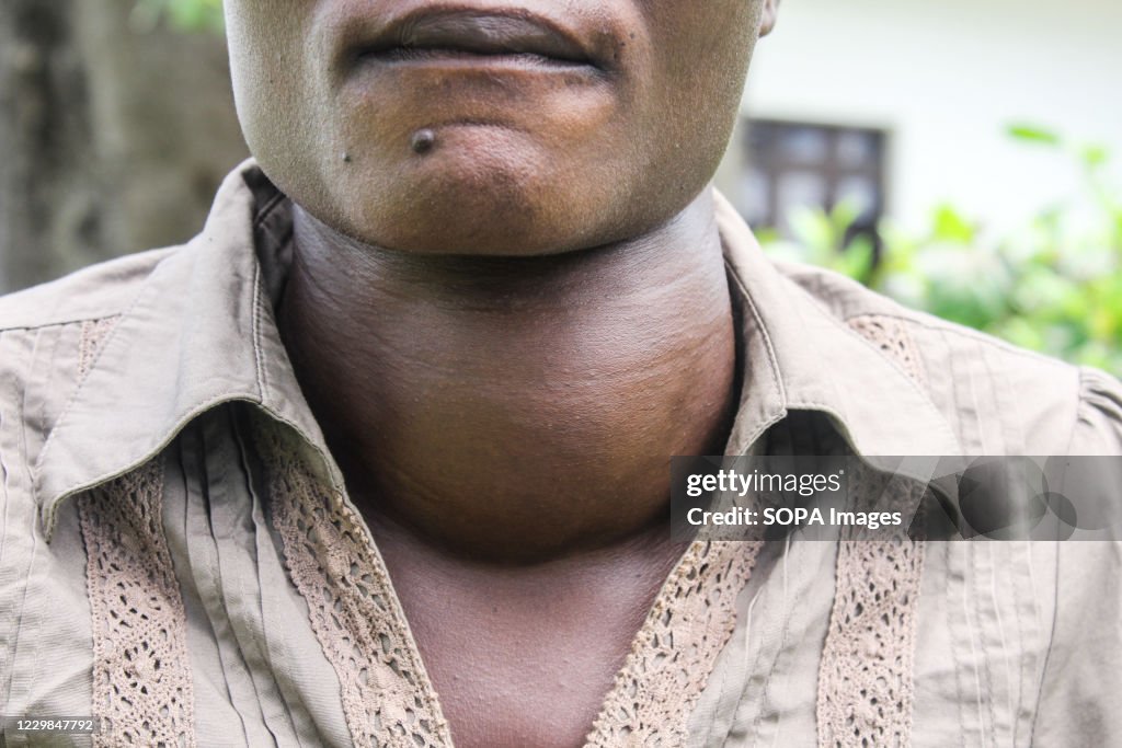 Irine Akinyi, 28 year old, a victim of lead poisoning in...
