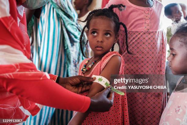Four-year-old Ethiopian girl who fled the Tigray conflict as a refugee is measured at a malnutrition center at Village Eight transit centre near the...