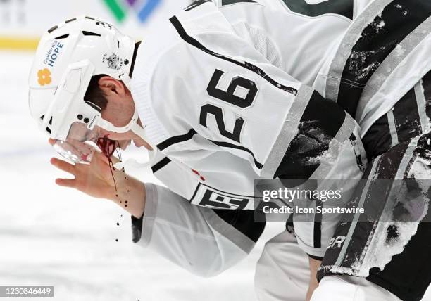 Los Angeles Kings Defenceman Sean Walker is bloodied after being hit in the face with a slap shot by Minnesota Wild Defenceman Matt Dumba during an...