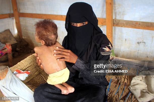 Yemeni child Meshaal Mohammad, a four-year-old weighs nine kilogrammes due to acute malnutrition, is held by his mother inside a hut at a camp for...