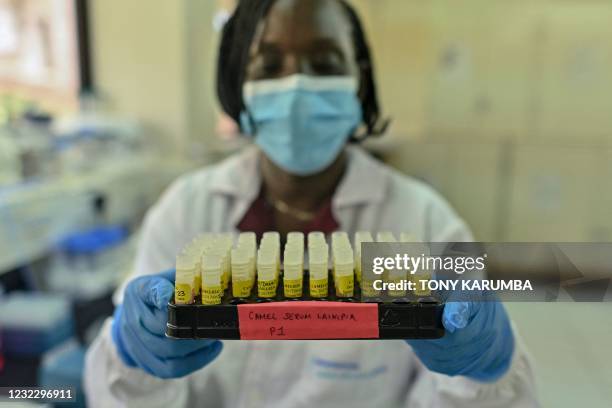 Alice Kiyong'a, a research associate and biologist, analyses serum drawn from a camel's blood for the Middle East Respiratory Syndrome virus at the...