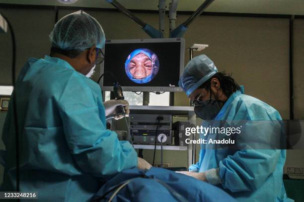 Specialist Dr. Brajpal Singh Tyagi performs a surgery to remove black fungus from a patient Adesh , who recovered from the coronavirus at a hospital...