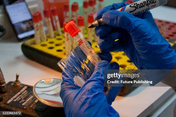 Health worker analyzes volunteers' blood samples in test tubes during the 'World Blood Donor Day' at the Caracas Municipal Blood Bank amid the...