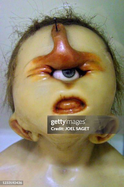 Photo prise le 12 avril 2001 d'un visage en cire d'enfant cyclocéphale exposé dans la "galerie de monstres" du musée Orfila-Rouvière à Paris. Ce...