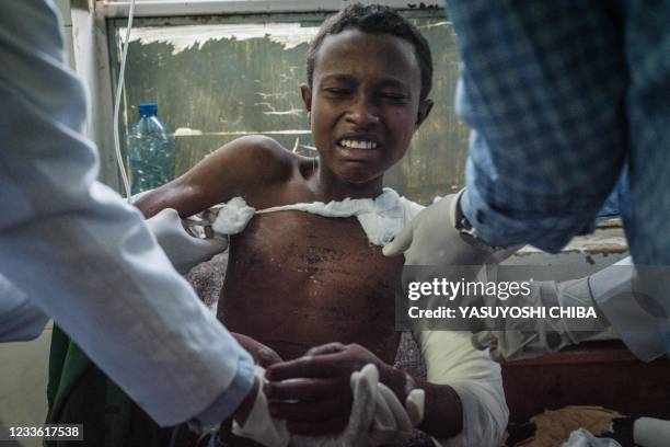 Graphic content / A Togoga injured residents, a village about 20km west of Mekele, where an alleged airstrike hit a market leaving an unknown number...