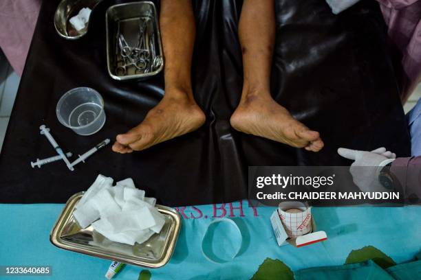 Boy is circumcised during a mass circumcision at the Indonesian police hospital in Banda Aceh on June 25, 2021.