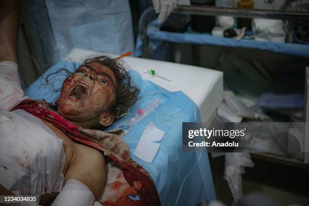 An injured child is seen inside an ambulance after attacks by the forces of the Bashar al-Assad regime and its supporters in a de-escalation zone in...