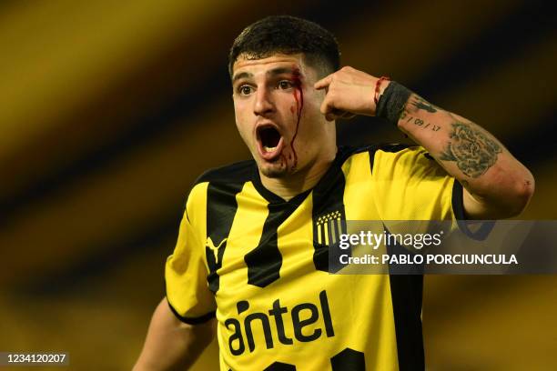 Penarol's Agustin Alvarez Martinez bleeds after getting hurt during the all-Uruguayan Copa Sudamericana round of 16 second leg derby football match...