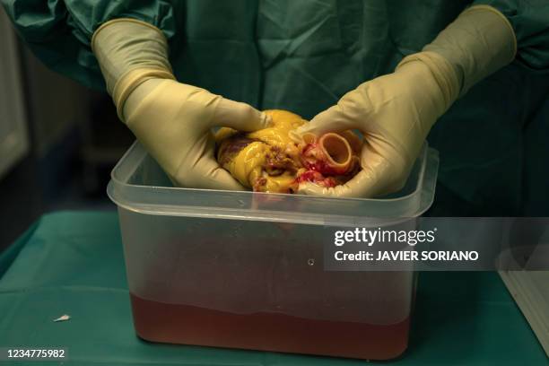 Cardiovascular surgeon Juan Esteban de Villarreal prepares a donor's heart to be implanted in a patient, at an operating theatre in Puerta de Hierro...