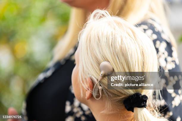 August 2021, Lower Saxony, Hanover: A girl wears a cochlear implant at the presentation of the project "Out of Silence into Sound" by Aktion...