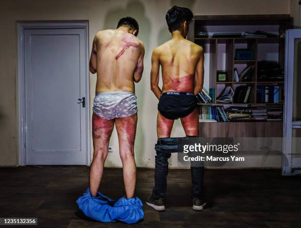 Journalists from the Etilaatroz newspaper, Nemat Naqdi a video journalist, left and Taqi Daryabi video editor undress to show their wounds sustained...