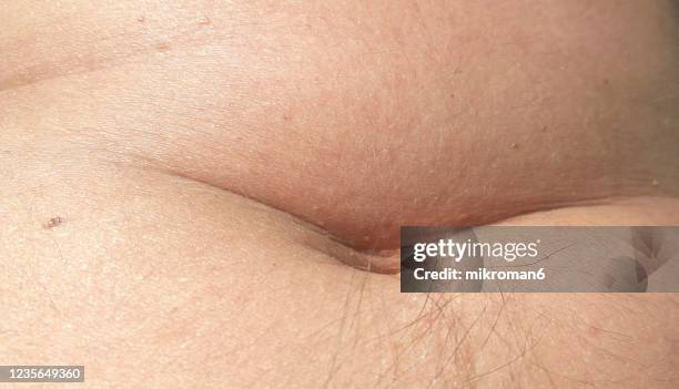 the belly of an obese older man - woman's bare body stock pictures, royalty-free photos & images