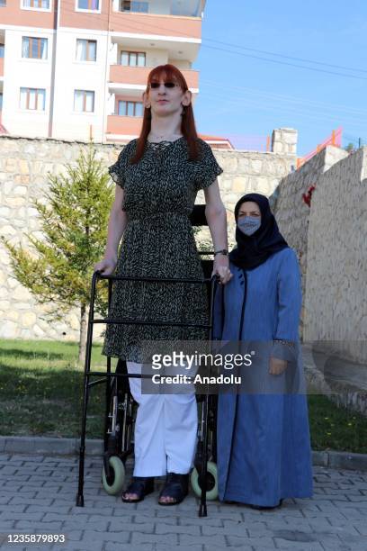 Year-old Turkish woman Rumeysa Gelgi , who stands 215.16 centimeters tall and has been confirmed as the world's tallest living woman by Guinness...