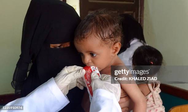 Woman holds a malnourished child at a treatment centre in Yemen's western province of Hodeida, on October 16, 2021. - Tens of thousands of people...