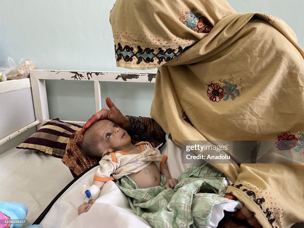 Afghan children on the verge of death due to starvation, struggle to survive in hospitals