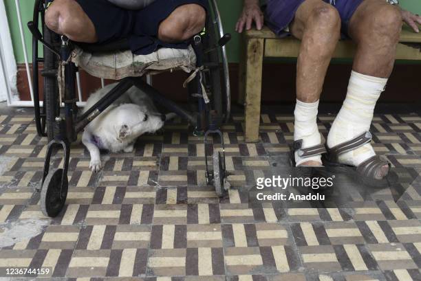 Leprosy patients are seen as they suffer from lack of supplies at Curupaiti Colony Hospital in Rio de Janeiro, Brazil on November 21, 2021.The...