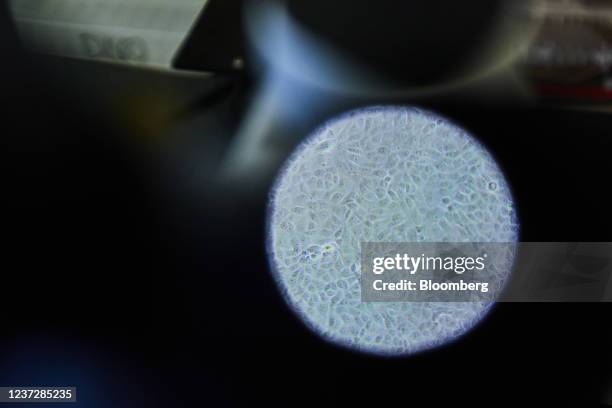 Sample of cell cultures under a microscope during Covid-19 antibody neutralization testing in a laboratory at the African Health Research Institute...