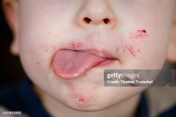 Child sticks out its tongue on January 18, 2022 in Berlin, Germany.