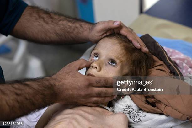 October 25: At the Indira Ghandi Childrens hospital a doctor examines Ruqia Jan suffering from severe malnutrition and diabetes on October 25,2021 in...