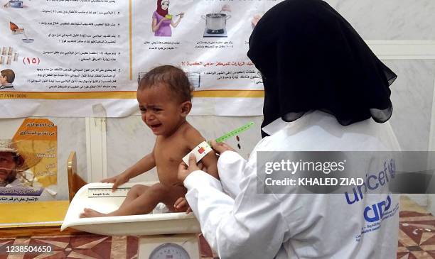 Nurse tends to a malnourished child at a treatment centre in Yemen's western province of Hodeida on February 15, 2022.