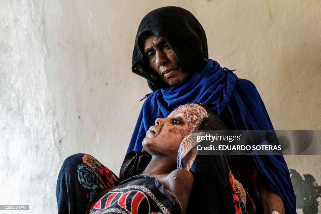 TOPSHOT-ETHIOPIA-UNREST-POLITICS