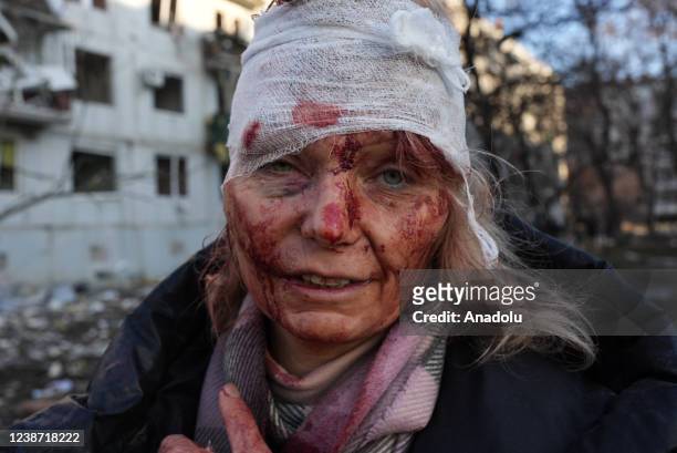 Wounded woman, named locally as Olena Kurilo, is seen after an airstrike damages an apartment complex outside of Kharkiv, Ukraine on February 24,...
