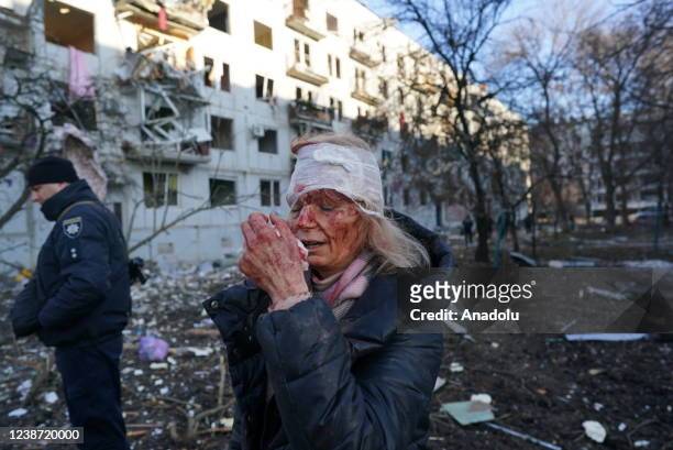 Wounded woman, named locally as Olena Kurilo, is seen after an airstrike damages an apartment complex outside of Kharkiv, Ukraine on February 24,...