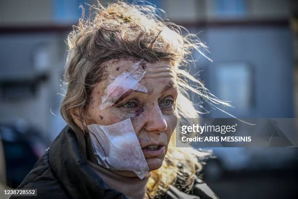 Olena Kurylo, a 52-year-old teacher stands outside a hospital after the bombing of the eastern Ukraine town of Chuguiv on February 24 as Russian...