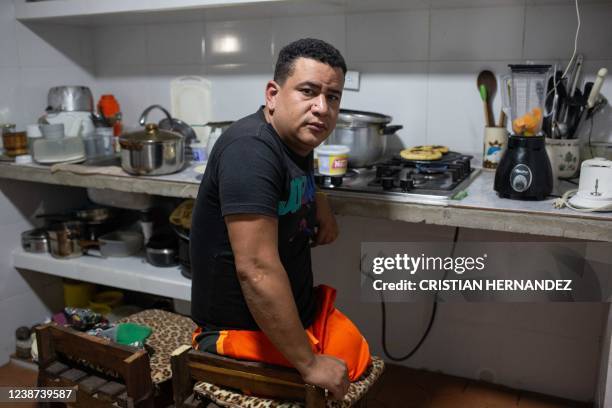 Cristhian Sequera Quintana poses for a picture at the kitchen of his house at the Cotiza neighborhood in Caracas, on December 17, 2021. - Amputees...