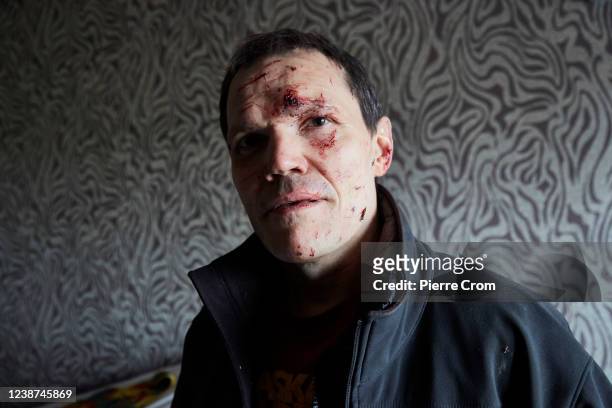 Vladimir collects belongings in his bedroom damaged by a missile on February 25, 2022 in Kyiv, Ukraine. Vladimir was wounded on his face by a...