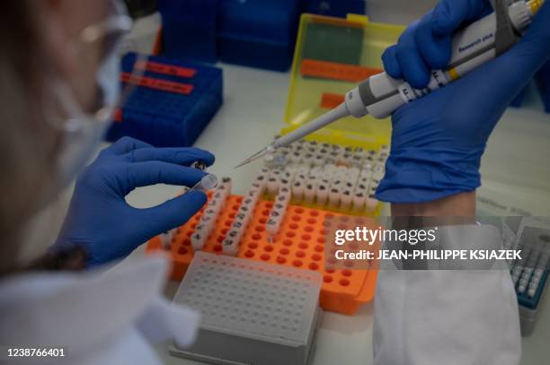 Researchers from the Auragen laboratory prepare the sequencing of human genomes to better identify rare diseases, in Lyon, central-estern France, on...