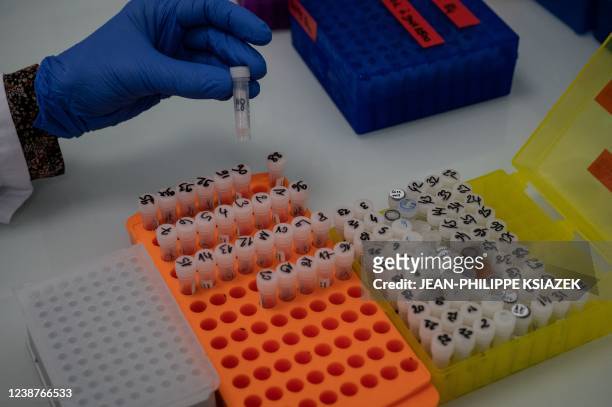 Researchers from the Auragen laboratory prepare the sequencing of human genomes to better identify rare diseases, in Lyon, central-estern France, on...