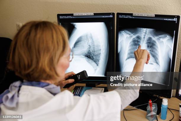 March 2022, Bavaria, Gauting: Dr. Natalie Wöhrle, radiologist, analyzes the X-ray images of the lungs of a person who has fled from Ukraine in her...