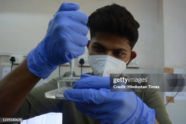 Pathologists examine the samples for Tuberculosis at pathology department of TMC's C.R. Wadia Hospital, in Thane on March 19, 2022 in Mumbai, India.