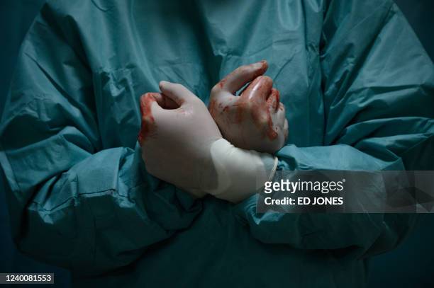 Doctor holds-up latex gloved hands covered in blood while standing outside an operating theatre during an operation on the leg of a wounded Ukrainian...