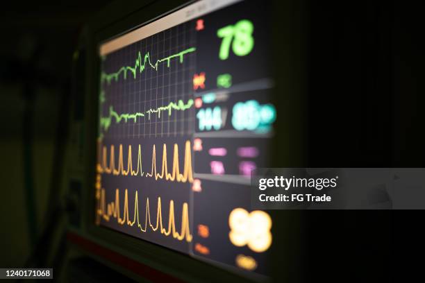 monitor of vital signs in the operating room - bloody heart stock pictures, royalty-free photos & images