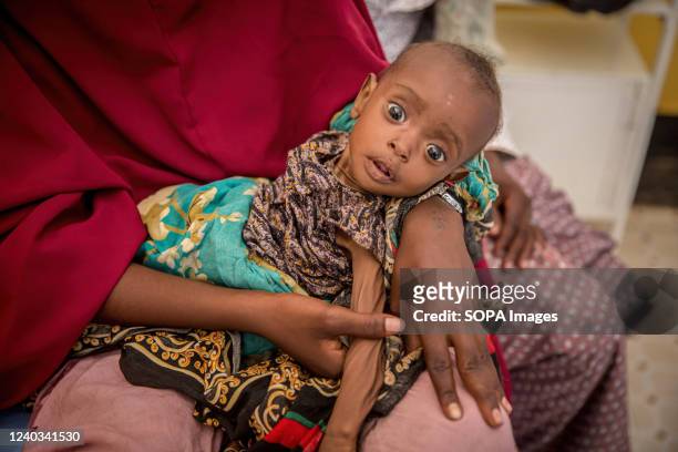 An eight-month-old baby pictured in the stabilisation ward of a referral treatment centre, where malnourished children are cared for in Dollow,...