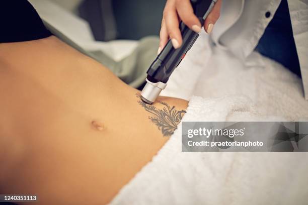 young woman on laser tattoo removal procedure - tattoos stock pictures, royalty-free photos & images