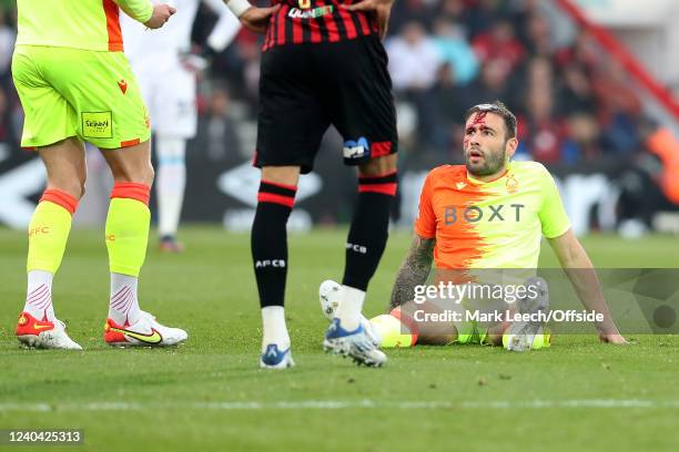 Steve Cook of Nottingham Forest with a bloody head injury during the Sky Bet Championship match between AFC Bournemouth and Nottingham Forest at...